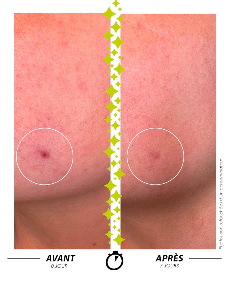 [ L'ELIXIR DU MARABOUT ]