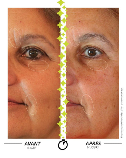 [ À la belle ÉTOILE ]