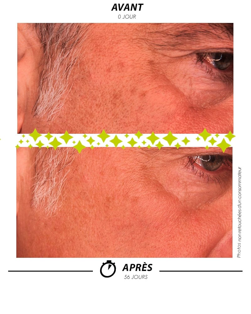 [ ÉCLAIR de LUNE L'Absolu ]