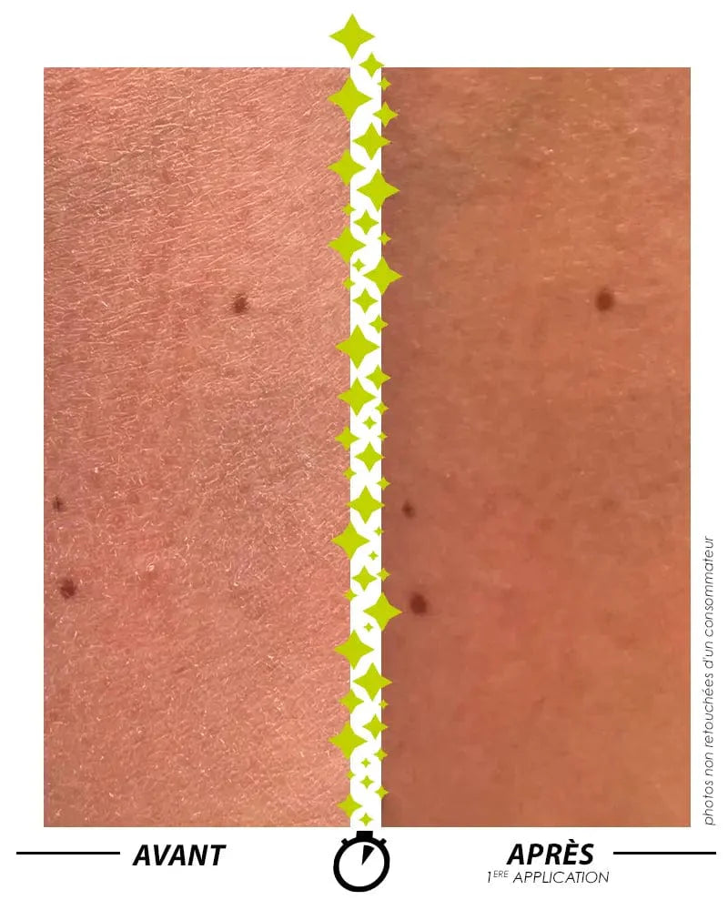 [ Formule ENSORCELANTE ANTI-PEAU DE CROCO ]