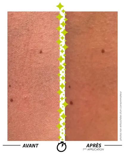 [ Formule ENSORCELANTE ANTI-PEAU DE CROCO ]