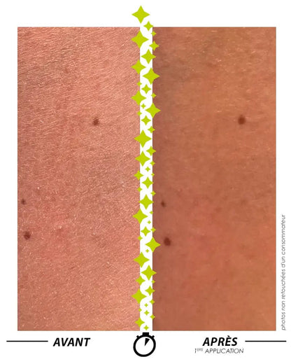 [ Formule ENSORCELANTE ANTI-PEAU DE CROCO ] SANS PARFUM