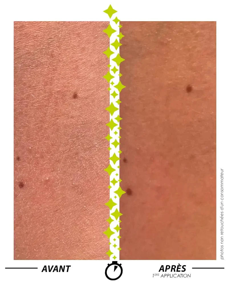 [ Formule ENSORCELANTE ANTI-PEAU DE CROCO ] 150 ML