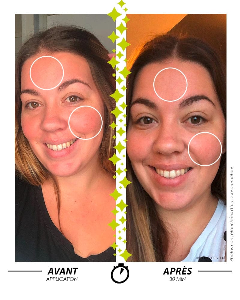 [ Que mes ROUGEURS Disparaissent ! ] SÉRUM